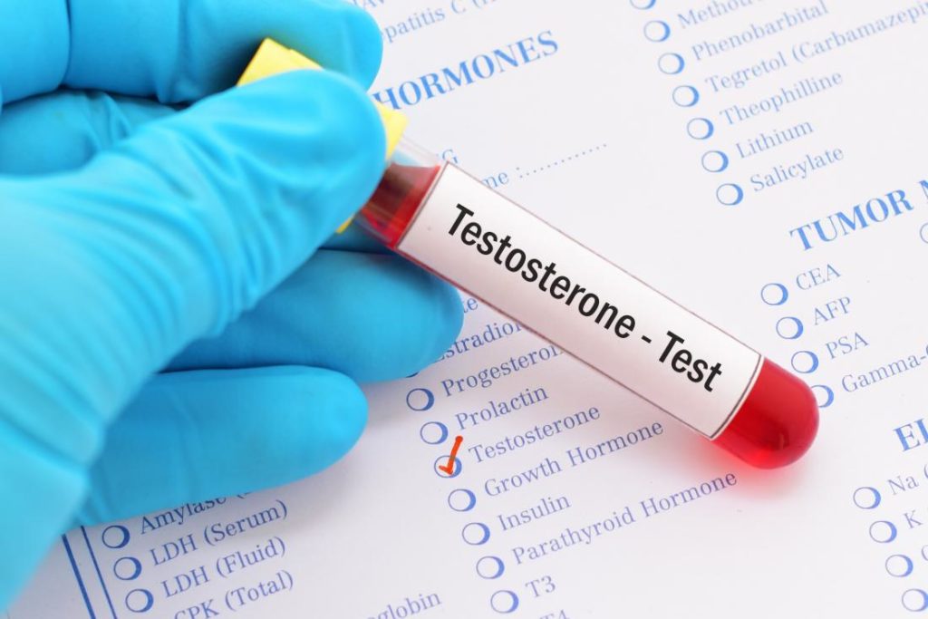 blood test for testosterone